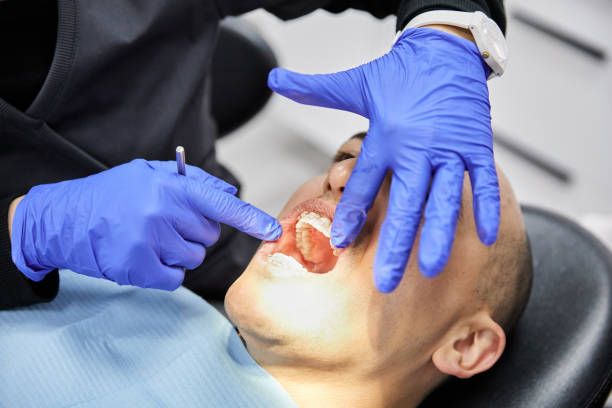 Best Emergency Gum Pain Relief  in Norton, OH