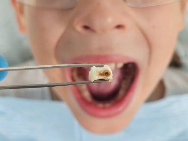 Best Tooth Pain Emergency Relief  in Norton, OH